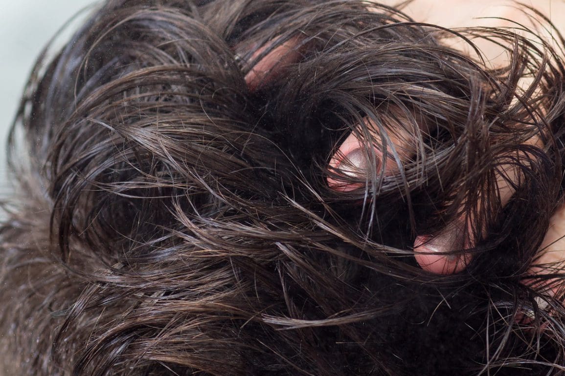 Je wilde haren terug met een haartransplantatie