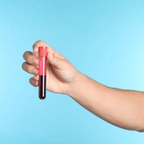 SOA test doen? Dit is het verschil tussen de huisarts, GGD en een privékliniek