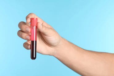 SOA test doen? Dit is het verschil tussen de huisarts, GGD en een privékliniek