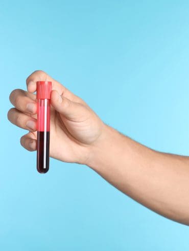 SOA test doen? Dit is het verschil tussen de huisarts, GGD en een privékliniek